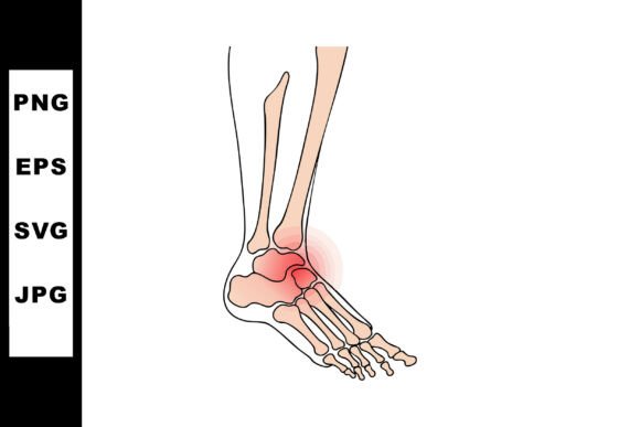 Human Ankle Joint Anatomy with Inflammat Review
